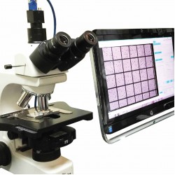Male Infertility Evaluation
