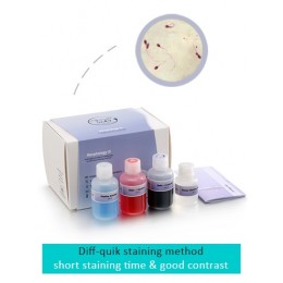 Sperm Processor Morphology